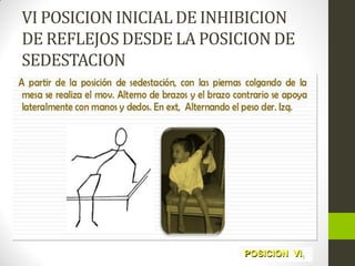 VI POSICION INICIAL DE INHIBICION
DE REFLEJOS DESDE LA POSICION DE
SEDESTACION
 