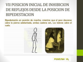 VII POSICION INICIAL DE INHIBICION
DE REFLEJOS DESDE LA POSICION DE
BIPEDESTACION
 