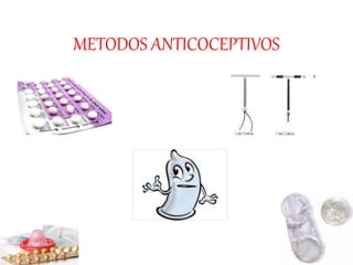METODOS ANTICOCEPTIVOS
 