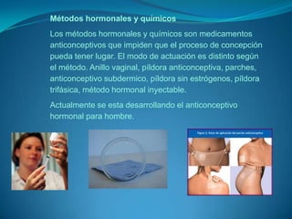 Métodos hormonales y químicosLos métodos hormonales y químicos son medicamentos anticonceptivos que impiden que el proceso de concepción pueda tener lugar. El modo de actuación es distinto según el método. Anillo vaginal, píldora anticonceptiva, parches, anticonceptivo subdermico, píldora sin estrógenos, píldora trifásica, método hormonal inyectable.Actualmente se esta desarrollando el anticonceptivo hormonal para hombre.