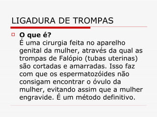 LIGADURA DE TROMPAS O que é?  É uma cirurgia feita no aparelho genital da mulher, através da qual as trompas de Falópio (tubas uterinas) são cortadas e amarradas. Isso faz com que os espermatozóides não consigam encontrar o óvulo da mulher, evitando assim que a mulher engravide. É um método definitivo. 