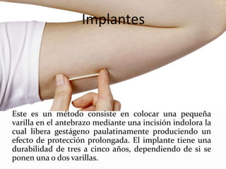 Implantes
Este es un método consiste en colocar una pequeña
varilla en el antebrazo mediante una incisión indolora la
cual libera gestágeno paulatinamente produciendo un
efecto de protección prolongada. El implante tiene una
durabilidad de tres a cinco años, dependiendo de si se
ponen una o dos varillas.
 