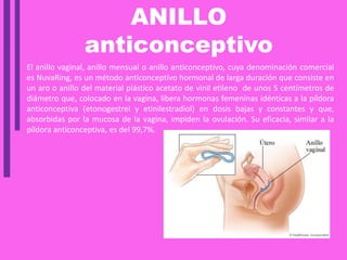 ANILLO
anticonceptivo
El anillo vaginal, anillo mensual o anillo anticonceptivo, cuya denominación comercial
es NuvaRing, es un método anticonceptivo hormonal de larga duración que consiste en
un aro o anillo del material plástico acetato de vinil etileno de unos 5 centímetros de
diámetro que, colocado en la vagina, libera hormonas femeninas idénticas a la píldora
anticonceptiva (etonogestrel y etinilestradiol) en dosis bajas y constantes y que,
absorbidas por la mucosa de la vagina, impiden la ovulación. Su eficacia, similar a la
píldora anticonceptiva, es del 99,7%.
 