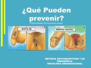 METODOS ANTICONCEPTIVOS Y DE
EMERGENCIA.
PSICOLOGIA ORGANIZACIONAL
Enfermedades de trasmisión sexual.
¿Qué Pueden
prevenir?
 