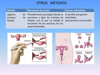 OTROS MÉTODOS
Método Mecanismo de acción Efectos indeseables
Ligadura de
trompas de
Falopio
Procedimiento quirúrgico donde se
seccionan y ligan las trompas de
Falopio, con lo que se impide el
encuentro de los ovocitos con los
espermatozoides.
Es posible que genere
esterilidad
permanente e irreversible.
 