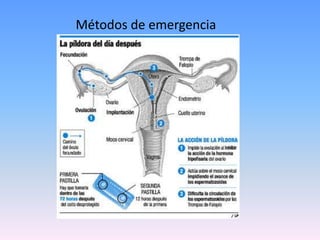 Métodos de emergencia
 