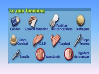 Metodos anticonceptivos