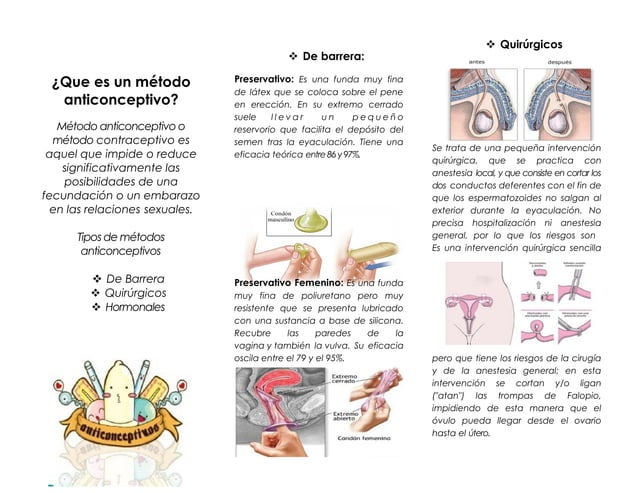 Metodos anticonceptivos triptico