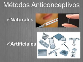 Métodos Anticonceptivos
Naturales
Artificiales
 