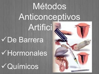 Métodos
Anticonceptivos
Artificiales:
De Barrera
Hormonales
Químicos
 