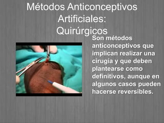 Métodos Anticonceptivos
Artificiales:
Quirúrgicos
Son métodos
anticonceptivos que
implican realizar una
cirugía y que deben
plantearse como
definitivos, aunque en
algunos casos pueden
hacerse reversibles.
 