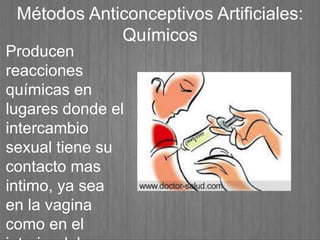 Métodos Anticonceptivos Artificiales:
Químicos
Producen
reacciones
químicas en
lugares donde el
intercambio
sexual tiene su
contacto mas
intimo, ya sea
en la vagina
como en el
 