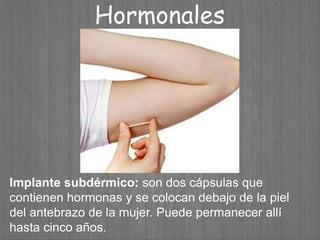 Implante subdérmico: son dos cápsulas que
contienen hormonas y se colocan debajo de la piel
del antebrazo de la mujer. Puede permanecer allí
hasta cinco años.
Hormonales
 