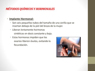 MÉTODOSQUÍMICOSYHORMONALES
• Implante Hormonal:
• Son seis pequeños tubos del tamaño de una cerilla que se
insertan debajo de la piel del brazo de la mujer.
• Liberan lentamente hormonas
sintéticas en dosis constante y baja.
• Estas hormonas impiden que los
ovarios liberen óvulos, evitando la
fecundación.
 