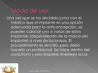 Una vez que se ha decidido junto con el
médico que el implante es una opción
adecuada para la anticoncepción, se
pueden colocar uno o varios de estos
implantes (dependiendo de la marca del
implante) a nivel de los brazos. El
procedimiento es sencillo, pero debe
hacerlo un profesional. Se hace dentro del
consultorio y solo requiere anestesia local.

Aldana Abregu- Ayelen Garcia

 