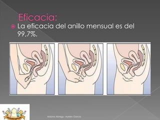 

La eficacia del anillo mensual es del
99,7%.

Aldana Abregu- Ayelen Garcia

 