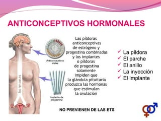 ANTICONCEPTIVOS HORMONALES
 La píldora
 El parche
 El anillo
 La inyección
 El implante
NO PREVIENEN DE LAS ETS
 
