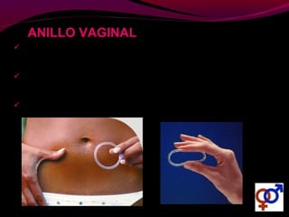  Es un anillo de plástico flexible, suave y transparente de 5 cm de
diámetro.
 Su uso UNA VEZ AL MES le confiere niveles hormonales ultra bajos
constantes durante todo el mes.
 Presenta una eficacia del 99,7%.
ANILLO VAGINAL
 