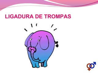 LIGADURA DE TROMPAS
 