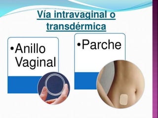 Metodos anticonceptivos  