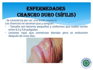 METODOS ANTICONCEPTIVOS y enfermedades de transmisión sexual | PPTX