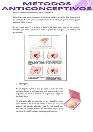 necesita retirarse inmediatamente tras la eyaculación.
Falla si se rompe o se pone después de que haya habido penetración, debe desecharse si
ha caducado. No usar junto con el preservativo masculino, ya que la fricción puede
ocasionar fallos o roturas.
Es importante guiar el pene hacia el interior del preservativo para un uso correcto,
evitando que pueda introducirse entre la pared de la vagina y el exterior del
preservativo.
3. Diafragma:
Es una pequeña cúpula de hule que cubre el cuello del útero
que generalmente se utiliza con una jalea anticonceptiva. Este
dispositivo se ubica al fondo de la vagina hasta llegar al
cuello del útero.
Su utilización debe ser asesorada por un especialista, quien
debe orientar a la mujer en cuanto al modo de uso y la
elección del tamaño adecuado, para lo cual tendrá que
realizarle un examen pélvico. Su desventaja radica en el
momento de retirarlo pues en ocasiones puede rasgarse.
 