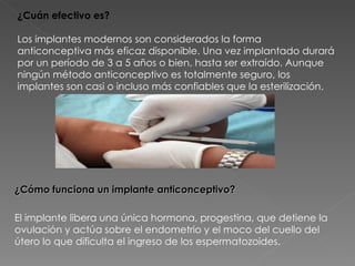 ¿Cuán efectivo es?

Los implantes modernos son considerados la forma
anticonceptiva más eficaz disponible. Una vez implantado durará
por un período de 3 a 5 años o bien, hasta ser extraído. Aunque
ningún método anticonceptivo es totalmente seguro, los
implantes son casi o incluso más confiables que la esterilización.




¿Cómo funciona un implante anticonceptivo?

El implante libera una única hormona, progestina, que detiene la
ovulación y actúa sobre el endometrio y el moco del cuello del
útero lo que dificulta el ingreso de los espermatozoides.
 