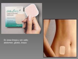 En área limpia y sin vello:
abdomen, glúteo, brazo
 