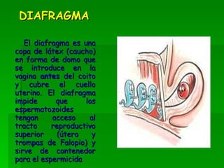 DIAFRAGMA El diafragma es una copa de látex (caucho) en forma de domo que se introduce en la vagina  antes  del coito y cubre el cuello uterino. El diafragma impide que los espermatozoides tengan acceso al tracto reproductivo superior (útero y trompas de Falopio) y sirve de contenedor para el espermicida   