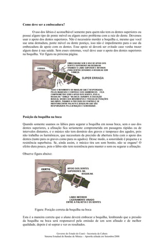 Como deve ser a embocadura?

       O uso dos lábios é aconselhável somente para quem não tem os dentes superiores ou
possui algum tipo de ponte móvel ou algum outro problema com a raiz do dente. Devemos
usar o apoio dos dentes superiores. Não é necessário morder a boquilha e, mesmo que você
use uma dentadura, ponte móvel ou dente postiço, isso não é impedimento para o uso da
embocadura de apoio com os dentes. Esse apoio só deverá ser evitado caso venha trazer
algum dano à sua saúde. Sem esses sintomas, você deve usar o apoio dos dentes superiores
na boquilha. Ver figura na próxima página.




Posição da boquilha na boca

Quando somente usamos os lábios para segurar a boquilha em nossa boca, sem o uso dos
dentes superiores, a afinação fica seriamente comprometida em passagens rápidas ou de
intervalos distantes, e o músico não tem domínio dos graves e tampouco dos agudos, pois
não trabalha os harmônicos, que necessitam da precisão de abertura feita com o apoio dos
dentes (tanto para os graves como para os agudos). Desse modo, a sonoridade é pequena e a
resistência superbaixa. Se, ainda assim, o músico tira um som bonito, não se engane! O
efeito dura pouco, pois o lábio não tem resistência para manter o som ou segurar a afinação.

Observe figura abaixo:




         Figura: Posição correta da boquilha na boca

Esta é a maneira correta que o aluno deverá embocar a boquilha, lembrando que a pressão
da boquilha na boca será responsavel pela emissão de um som afinado e de melhor
qualidade, depois é só soprar e ver os resultados.

                            Governo do Estado do Ceará – Secretaria da Cultura
                Sistema Estadual de Bandas de Música – Apostila editada em Setembro/2008
 