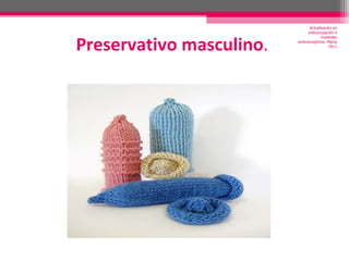 Preservativo masculino . Actualización en anticoncepción e implantes anticonceptivos. Marzo 2011 