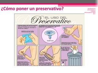 ¿Cómo poner un preservativo? Actualización en anticoncepción e implantes anticonceptivos. Marzo 2011 