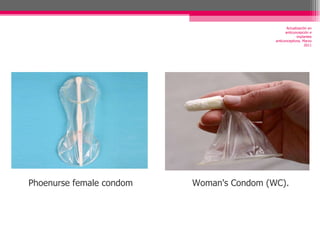 Actualización en anticoncepción e implantes anticonceptivos. Marzo 2011 Phoenurse female condom Woman's Condom (WC). 