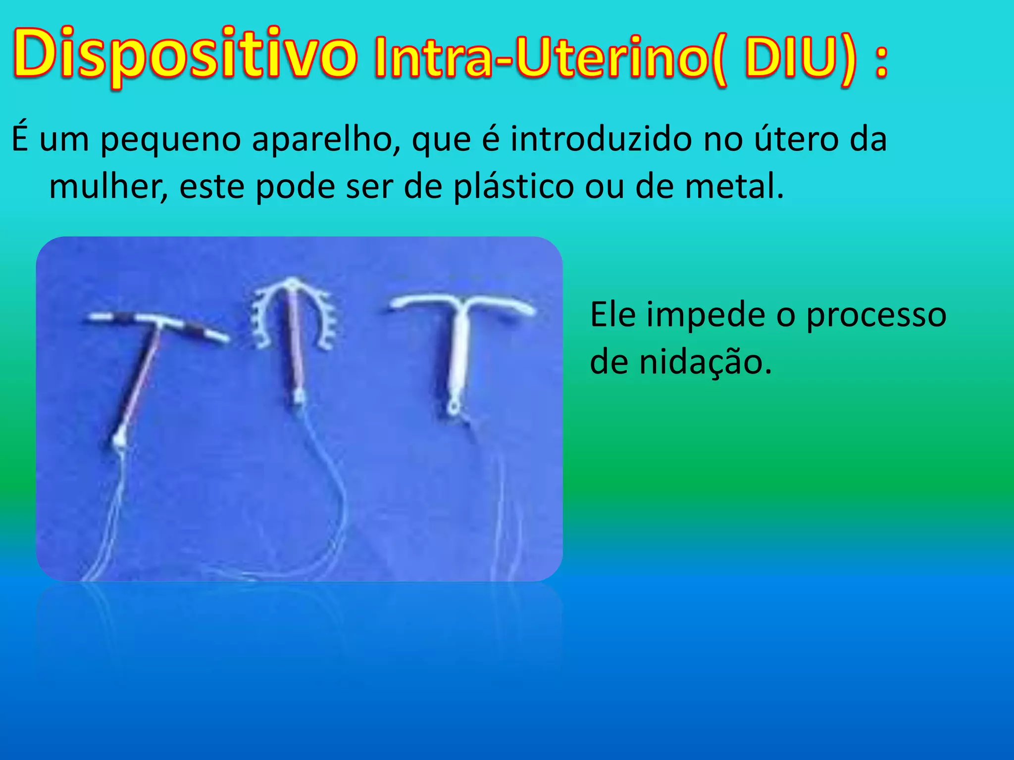 DispositivoIntra-Uterino( DIU) :É um pequeno aparelho, que é introduzido no útero da mulher, este pode ser de plástico ou de metal.Ele impede o processo de nidação. 