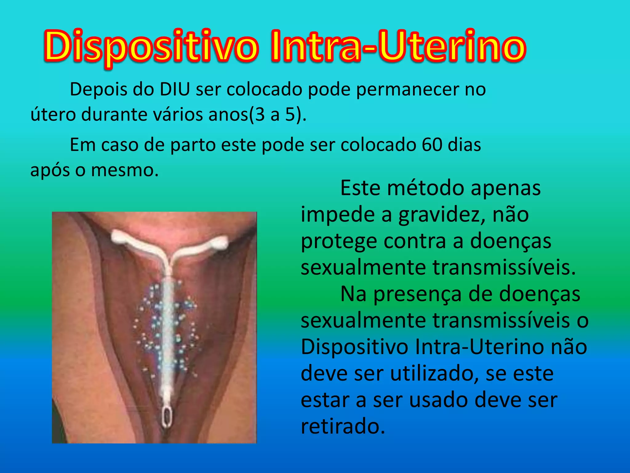 Dispositivo Intra-Uterino		Depois do DIU ser colocado pode permanecer no útero durante vários anos(3 a 5).		Em caso de parto este pode ser colocado 60 dias após o mesmo. Este método apenas impede a gravidez, não protege contra a doenças sexualmente transmissíveis. 	Na presença de doenças sexualmente transmissíveis o Dispositivo Intra-Uterino não deve ser utilizado, se este estar a ser usado deve ser retirado.