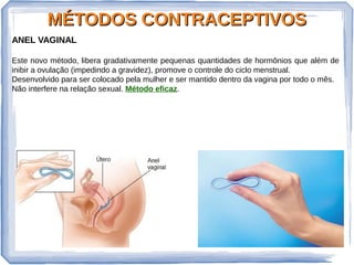 MÉTODOS CONTRACEPTIVOSMÉTODOS CONTRACEPTIVOS
ANEL VAGINAL
Este novo método, libera gradativamente pequenas quantidades de hormônios que além de
inibir a ovulação (impedindo a gravidez), promove o controle do ciclo menstrual.
Desenvolvido para ser colocado pela mulher e ser mantido dentro da vagina por todo o mês.
Não interfere na relação sexual. Método eficaz.
 