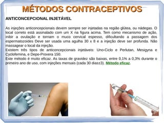 MÉTODOS CONTRACEPTIVOSMÉTODOS CONTRACEPTIVOS
ANTICONCEPCIONAL INJETÁVEL
As injeções anticoncepcionais devem sempre ser injetadas na região glútea, ou nádegas. O
local correto está assinalado com um X na figura acima. Tem como mecanismo de ação,
inibir a ovulação e tornam o muco cervical espesso, dificultando a passagem dos
espermatozoides Deve ser usada uma agulha 30 x 8 e a injeção deve ser profunda. Não
massagear o local da injeção.
Existem três tipos de anticoncepcionais injetáveis: Uno-Ciclo e Perlutan, Mesigyna e
Cyclofemina, e Depo-Provera 150.
Este método é muito eficaz. As taxas de gravidez são baixas, entre 0,1% a 0,3% durante o
primeiro ano de uso, com injeções mensais (cada 30 dias±3). Método eficaz.
 