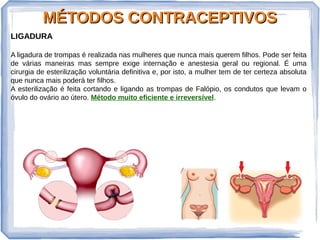 MÉTODOS CONTRACEPTIVOSMÉTODOS CONTRACEPTIVOS
LIGADURA
A ligadura de trompas é realizada nas mulheres que nunca mais querem filhos. Pode ser feita
de várias maneiras mas sempre exige internação e anestesia geral ou regional. É uma
cirurgia de esterilização voluntária definitiva e, por isto, a mulher tem de ter certeza absoluta
que nunca mais poderá ter filhos.
A esterilização é feita cortando e ligando as trompas de Falópio, os condutos que levam o
óvulo do ovário ao útero. Método muito eficiente e irreversível.
 