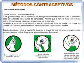 MÉTODOS CONTRACEPTIVOSMÉTODOS CONTRACEPTIVOS
CAMISINHA FEMININA
Como Colocar a Camisinha Feminina
É um grande avanço para a prevenção de doenças sexualmente transmissíveis. A camisinha
pode ser colocada horas antes da penetração. Permite que o homem faça sexo oral na
mulher. Evita gravidez e doenças sexualmente transmissíveis.
Para colocar a camisinha encontre uma posição confortável. Pode ser em pé com um pé em
cima de uma cadeira; sentada com os joelhos afastados; agachada ou deitada.
Depois da relação, retire a camisinha torcendo a argola de fora para que o esperma não
escorra e jogue-a no lixo. Nunca use a camisinha mais de uma vez.
Segure a argola menor com o
polegar e o indicador.
Aperte a argola e
introduza na vagina com o
dedo indicador.
Empurre-a com o dedo
indicador. A argola maior
fica para fora da vagina,
isso aumenta a proteção.
 