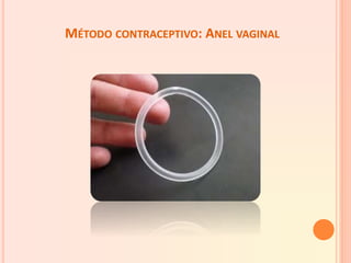 MÉTODO CONTRACEPTIVO: ANEL VAGINAL
 