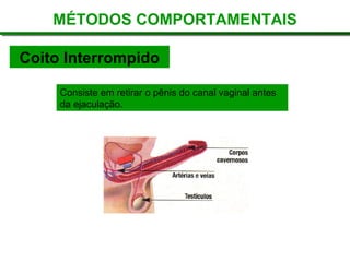 Coito Interrompido
Consiste em retirar o pênis do canal vaginal antes
da ejaculação.
MÉTODOS COMPORTAMENTAIS
 