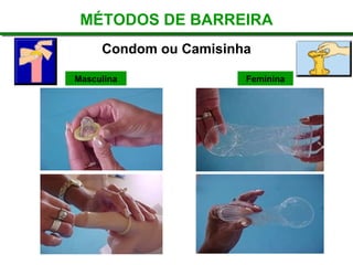 Condom ou Camisinha
Masculina Feminina
MÉTODOS DE BARREIRA
 