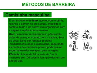 MÉTODOS DE BARREIRA
É um envoltório de látex que recobre o pênis,
retendo o sêmen no ato sexual, impedido o
contato deste e de outros microrganismos com
a vagina e o pênis ou vice-versa.
Uso: desenrolar a camisinha no pênis ereto,
antes de qualquer contato com a vagina, ânus
ou boca. Deve ser retirada do pênis
imediatamente após a ejaculação, segurando
as bordas da camisinha para impedir que os
espermatozóides escapem para a vagina.
Eficácia: A taxa de falha varia de 3 a 14
mulheres em 100 podem ficar grávidas em um
ano de uso.
Camisinha masculina
 