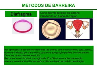 Diafragma Cone flexível de látex ou silicone
introduzido no fundo da vagina.
MÉTODOS DE BARREIRA
Por apresentar 6 tamanhos diferentes (de acordo com o tamanho do colo uterino),
deve ser indicado por um médico para uma adequação perfeita ao colo uterino.
Deve ser usado com espermicida.
Recomenda-se introduzir na vagina de 15 a 30 minutos antes da relação
sexual e só retirar 6 a 8 horas após a última relação sexual de penetração.
 