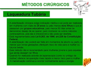MÉTODOS CIRÚRGICOS
Laqueadura Tubária
• A esterilização cirúrgica exige indicação médica e só pode ser realizada
em mulheres com mais de 25 anos ou pelo menos dois filhos e que já
passaram por grupos educativos, pelo menos 60 dias antes de
demonstrar desejo de se operar, para conhecer os outros métodos
contraceptivos, pois ela é irreversível e não pode ser desfeita.
• Está regulamentada pela Lei 9.263, de 1996. art.226 da Constituição
Federal.
• A esterilização não poderá ser feita em momentos de aborto ou parto, a
menos que novas gestações ofereçam risco de vida para a mulher ou
futuros bebês.
• Este método não é recomendado para mulheres jovens e para aquelas
que ainda desejam ter filhos
• Quando for realizada através de laparoscopia (corte no umbigo da
mulher) oferece recuperação mais rápida e menor risco para a mulher.
• A menstruação continua a ocorrer normalmente após a cirurgia.
 