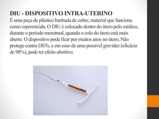 DIU - DISPOSITIVO INTRA-UTERINO
É uma peça de plásticobanhada de cobre, material que funciona
como espermicida.O DIU é colocadodentrodo útero pelo médico,
durante o períodomenstrual,quando o colo do úteroestá mais
aberto.O dispositivo pode ficar por muitos anos no útero,Não
protege contra DSTs, e em caso de uma possível gravidez (eficácia
de 98%), pode ter efeito abortivo.
 