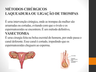 MÉTODOS CIRÚRGICOS
LAQUEADURAOU LIGAÇÃO DE TROMPAS
É uma intervenção cirúrgica,onde as trompas da mulher são
amarradas ou cortadas, evitandocom que o óvulo e os
espermatozoides se encontrem. É um método definitivo,
VASECTOMIA
É uma cirurgia feita na bolsa escrotaldo homem, por onde passa o
canal deferente.Esse canal é cortado, impedindoque os
espermatozoides cheguemao esperma.
 