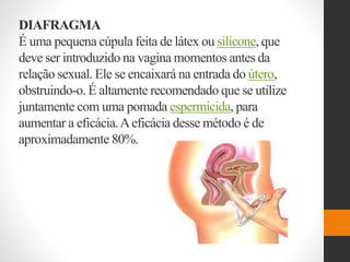 DIAFRAGMA
É uma pequena cúpula feita de látex ou silicone, que
deve ser introduzido na vagina momentos antes da
relação sexual. Ele se encaixará na entrada do útero,
obstruindo-o. É altamente recomendado que se utilize
juntamente com uma pomada espermicida, para
aumentar a eficácia.Aeficácia desse método é de
aproximadamente 80%.
 