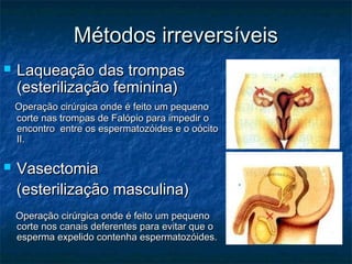 Métodos irreversíveisMétodos irreversíveis
 Laqueação das trompasLaqueação das trompas
(esterilização feminina)(esterilização feminina)
Operação cirúrgica onde é feito um pequenoOperação cirúrgica onde é feito um pequeno
corte nas trompas de Falópio para impedir ocorte nas trompas de Falópio para impedir o
encontro entre os espermatozóides e o oócitoencontro entre os espermatozóides e o oócito
II.II.
 VasectomiaVasectomia
(esterilização masculina)(esterilização masculina)
Operação cirúrgica onde é feito um pequenoOperação cirúrgica onde é feito um pequeno
corte nos canais deferentes para evitar que ocorte nos canais deferentes para evitar que o
esperma expelido contenha espermatozóides.esperma expelido contenha espermatozóides.
 