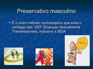 Preservativo masculinoPreservativo masculino
 É o único método contraceptivo que evita oÉ o único método contraceptivo que evita o
contágio das DST (Doenças Sexualmentecontágio das DST (Doenças Sexualmente
Transmissíveis), inclusive a SIDA.Transmissíveis), inclusive a SIDA.
 